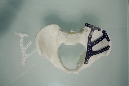 3D打印骨科模型